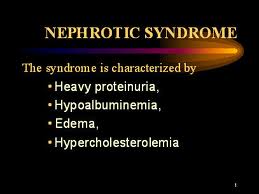 Nephrotic Syndrome 2